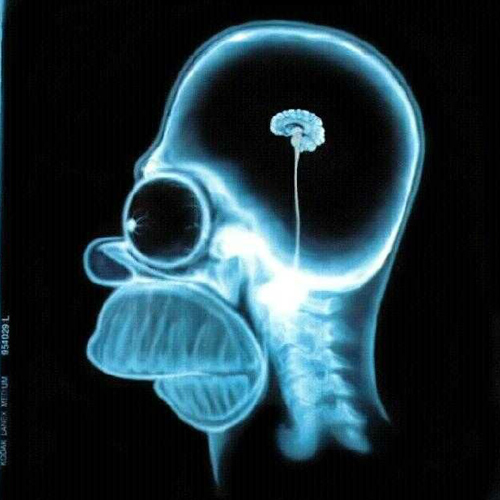 homer_simpson_xray.jpg