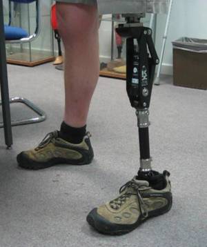 RTEmagicC_prosthetic_leg_01.jpg.jpg