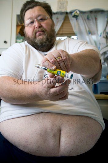 C0106846-Obese_man,_USA-SPL.jpg