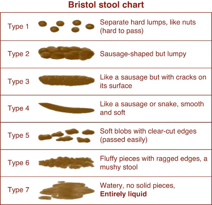 Bristol-stool-chart1.jpg