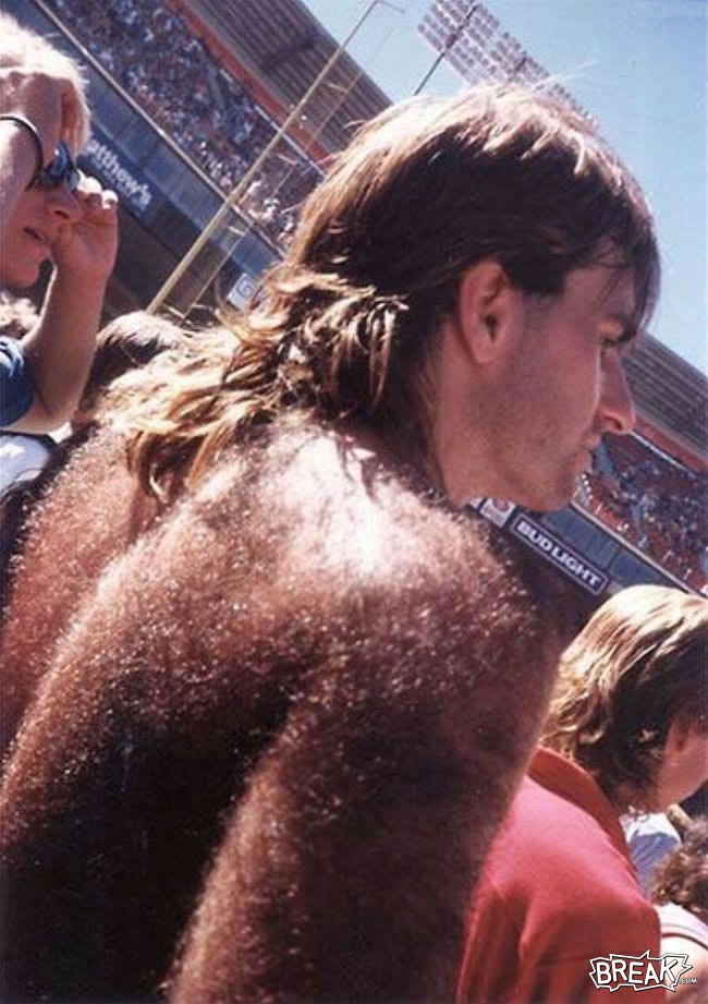 hairy-back-man.jpg