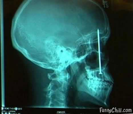 x-rays-01.jpg